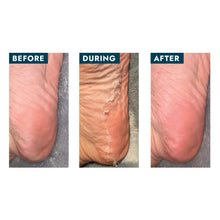 Load image into Gallery viewer, Voesh Peeling Socks, Single Pair
